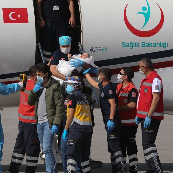 Cumhurbaşkanı Erdoğan, siyam ikizlerinin ailesini aradı