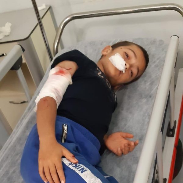 Sultangazi'de 8 yaşındaki Ubeyde'ye köpek saldırdı