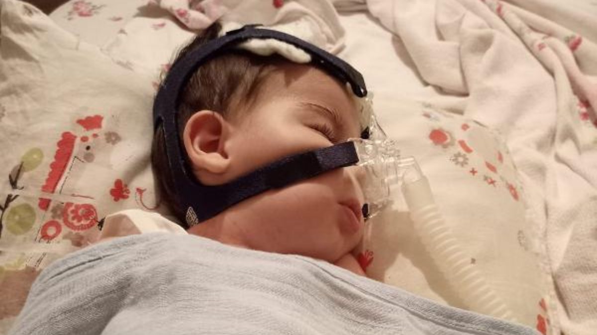 Bursa'da SMA hastası olan Ali Osman yardım bekliyor