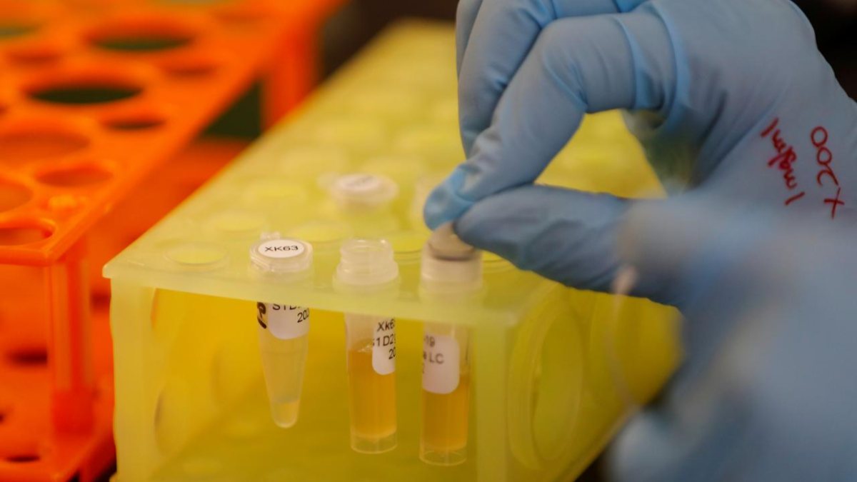 AstraZeneca, koronavirüse karşı antikor tedavisi denemesini başlattı