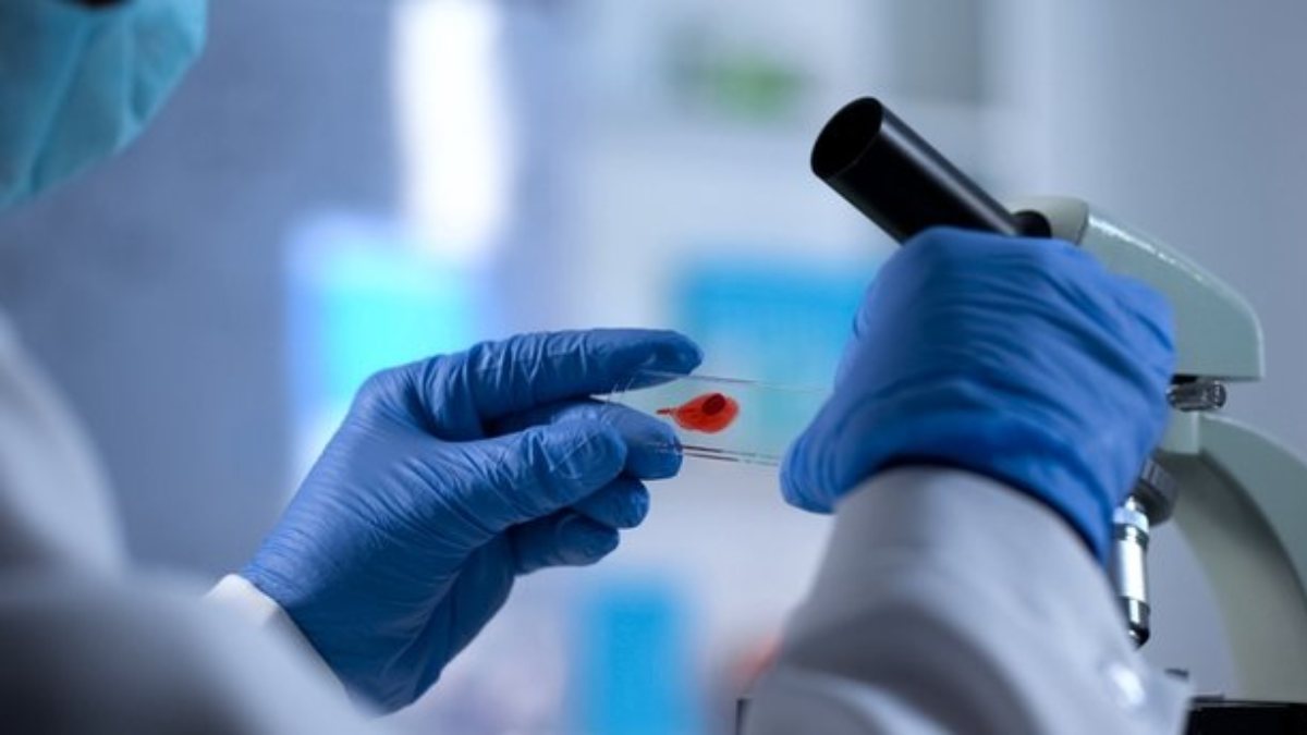 1 Aralık Dünya AIDS Günü: AIDS nedir, belirtileri nelerdir?