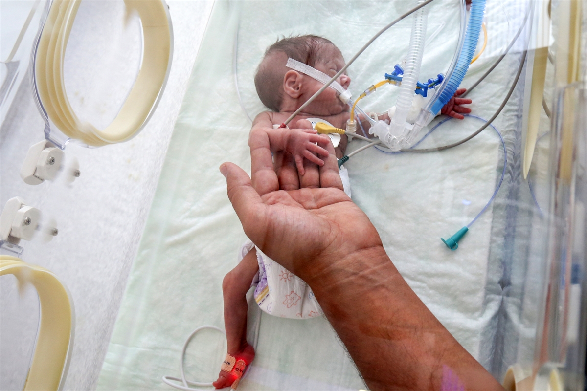 Mucize bebek hayata tutunmayı başardı Mucize bebek hayata tutunmayı başardı