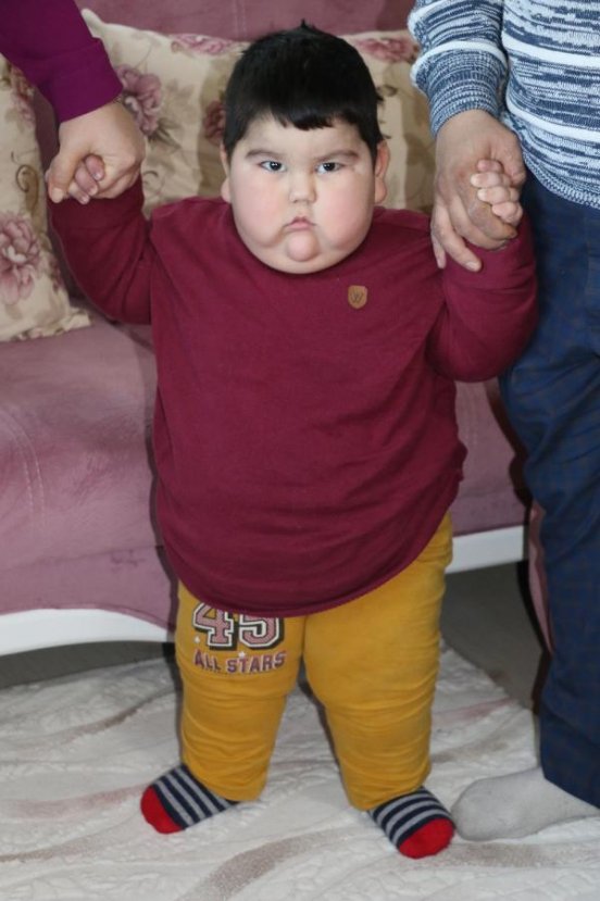 2 yaşında 29 kilo olan Yağız, Cumhurbaşkanı Erdoğan'la buluştu