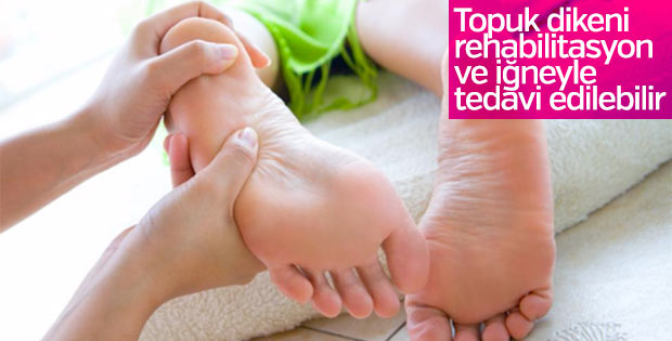 Topuk dikeni nedir