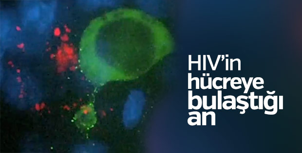 HIV'in hücrelere dağılışı ilk kez görüntülendi