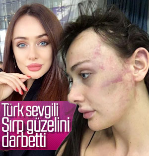 Kıskanç sevgili model sevgilisini darbetti