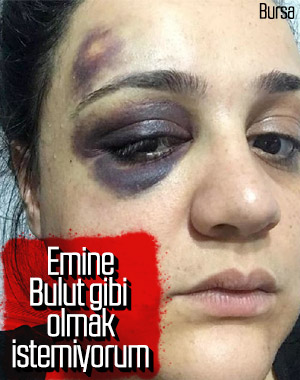 Eşinden dayak yiyen kadın ölümden korkuyor