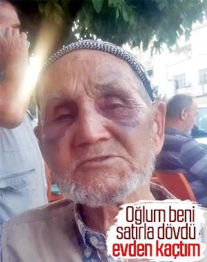 Sinop'ta babasını darbeden zanlı tutuklandı