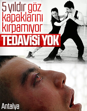 28 yaşında hastalığından yatağa mahkum oldu