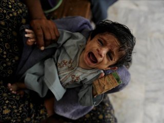Pakistan'da tek kentte 10 ayda 703 çocuk açlıktan öldü