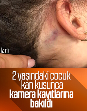 Anaokulunda işkence iddiası