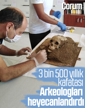 Çorum'da 3 bin 500 yıllık kafatası bulundu