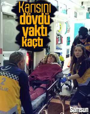 Eşini dövüp kaynar su ile yaktı