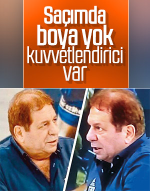 Erman Toroğlu saçlarına ne olduğunu açıkladı
