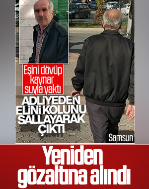 Eşini kaynar suyla yakan koca bu kez tutuklandı