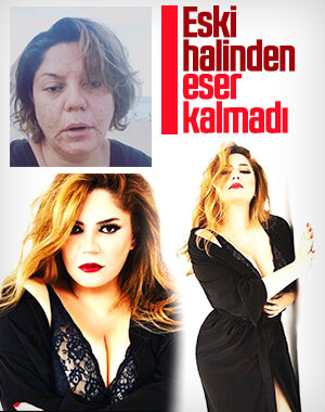 İzel, zayıfladı