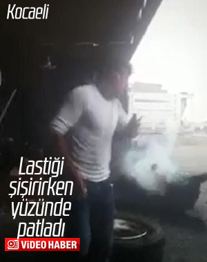 Tamir etmeye çalıştığı lastik, yüzünde patladı