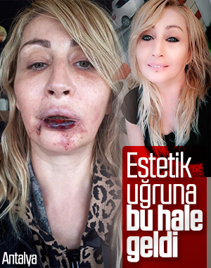 Güzellik uğruna hayatı karardı