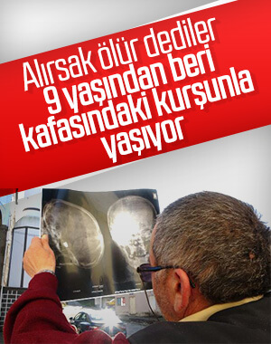 47 yıldır başında maganda kurşunuyla yaşıyor