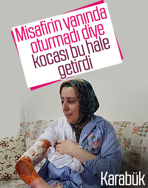 Misafirin yanında oturmadı diye eşini kaynar su ile yaktı