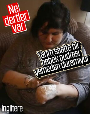 İngiltere'de yaşayan kadın 15 yıldır bebek pudrası yiyor