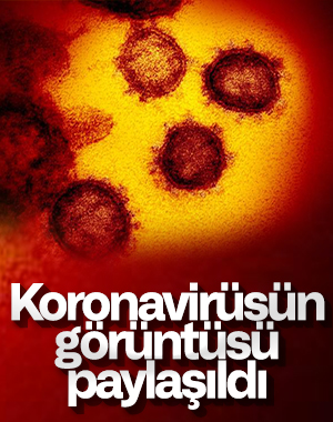 Koronavirüs fotoğrafları yayınlandı