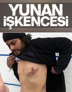 Yunan askerleri, Mısırlı göçmeni demir çubukla dövdü