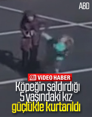 ABD'de küçük kıza köpek saldırdı