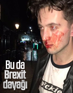 Brexit sonrası 'Gallisin, İngiltere'yi terk et' dayağı