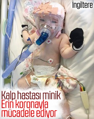 İngiltere’de altı aylık bebeğe korona teşhisi konuldu