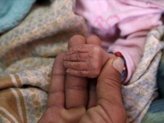 BM: 2020'de yüz binlerce çocuk ölebilir