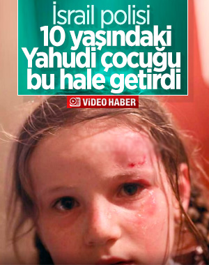 İsrail'de 10 yaşındaki kız çocuğu bombadan yaralandı