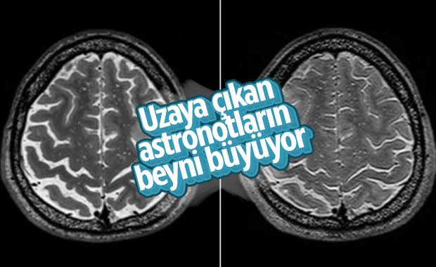 Uzayda yaşamanın insan beynini büyüttüğü ortaya çıktı