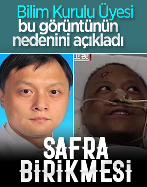 Bilim Kurulu Üyesi Tezer, ten rengi değişimini açıkladı