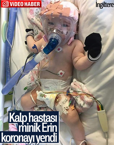 İngiltere'de altı aylık bebek, koronayı yenmeyi başardı