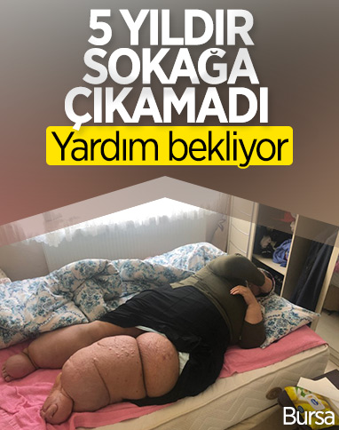 Fil hastası kadın sokağa çıkacağı günü bekliyor