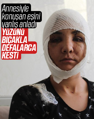 6 yıllık eşi tarafından yüzünden bıçaklandı