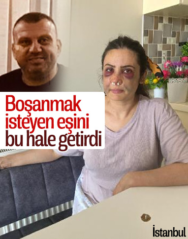 Kartal'da boşanmak istediği eşi tarafından darbedildi