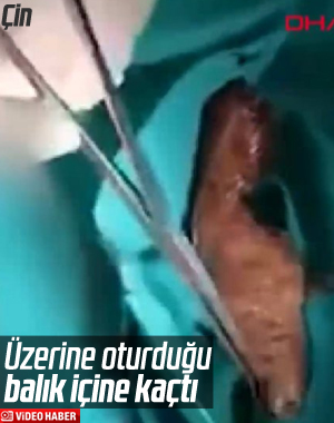 Çinli adamın rektumundan balık çıktı
