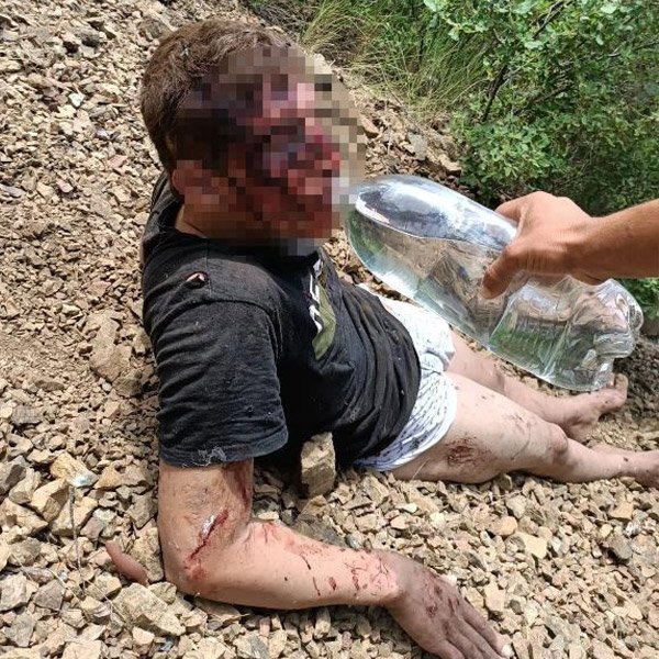 Hatay'da kayıp genç, 2 gün sonra dağda yaralı bulundu