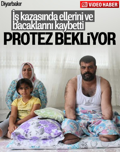 Diyarbakır'da protez el için yardım bekleyen vatandaş