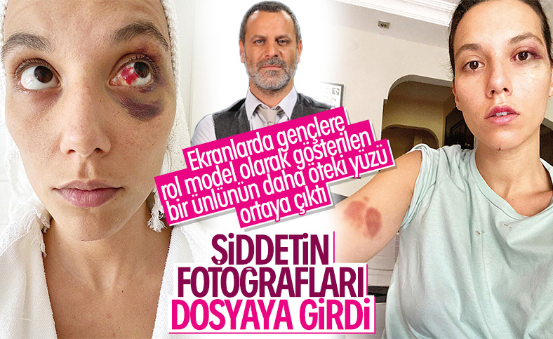 Deniz Bulutsuz'un darp sonrası fotoğrafı ortaya çıktı