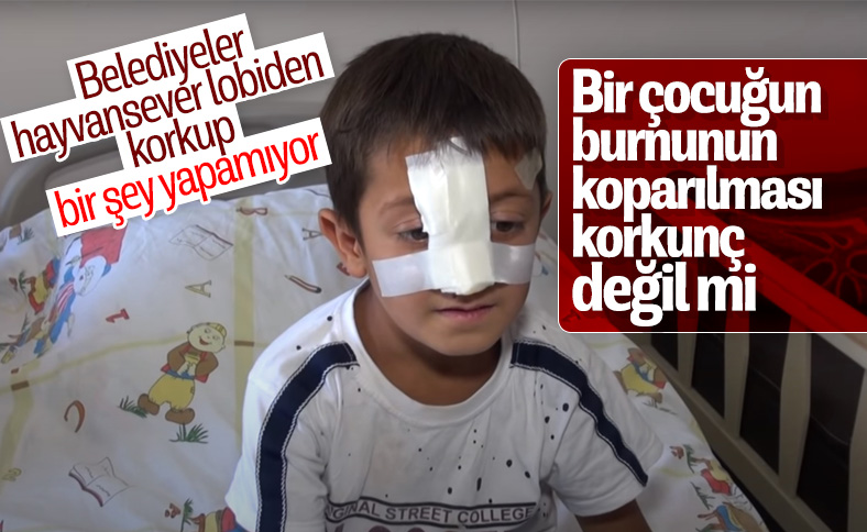 Ağrı'da sokak köpeği çocuğun burnunu koparttı