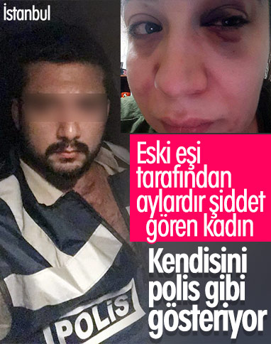 İstanbul'da eski eşinden şiddet gördü, yardım bekliyor