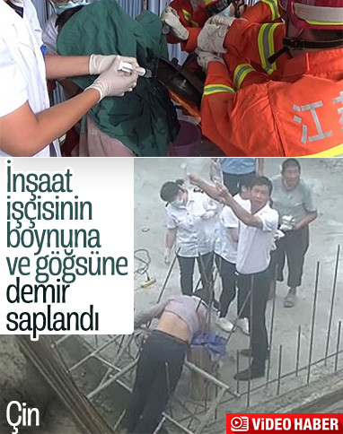 Çin'de demir saplanan inşaat işçisi ölümden döndü