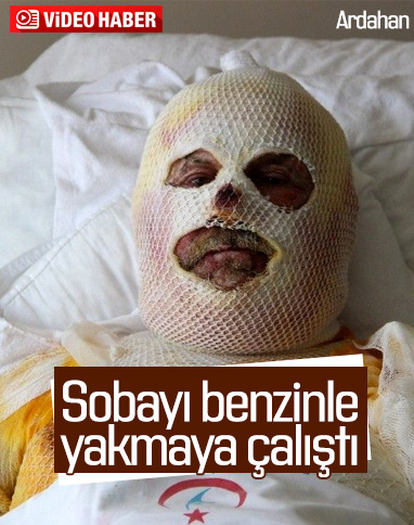 Ardahan'da çay demlemek için sobaya benzin döktü: Yandı