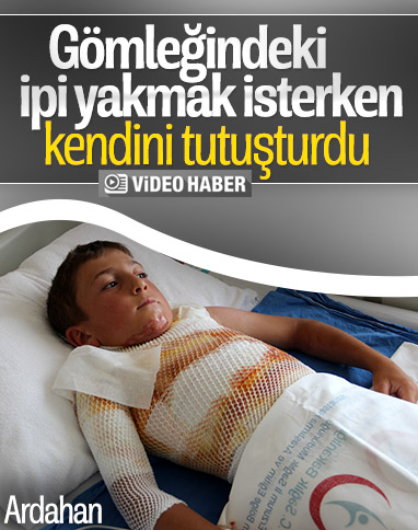 Ardahan’da gömleğindeki ip yerine kendini yaktı