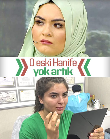 Hanife Gürdal, dudaklarını büyüttü