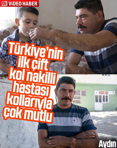 Türkiye'nin ilk çift kol nakilli Cihan Topal, kollarına gözü gibi bakıyor
