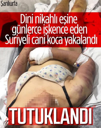 Şanlıurfa'da, dini nikahlı eşine işkence eden cani